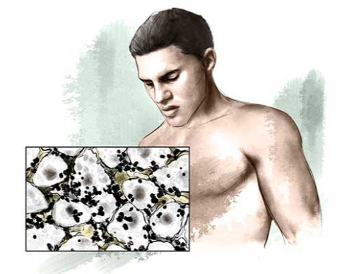 Toksiny-v-tele